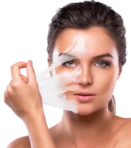 Chemical Peel Acne